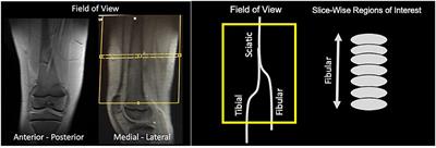 DTI and MTR Measures of Nerve Fiber Integrity in Pediatric Patients With Ankle Injury